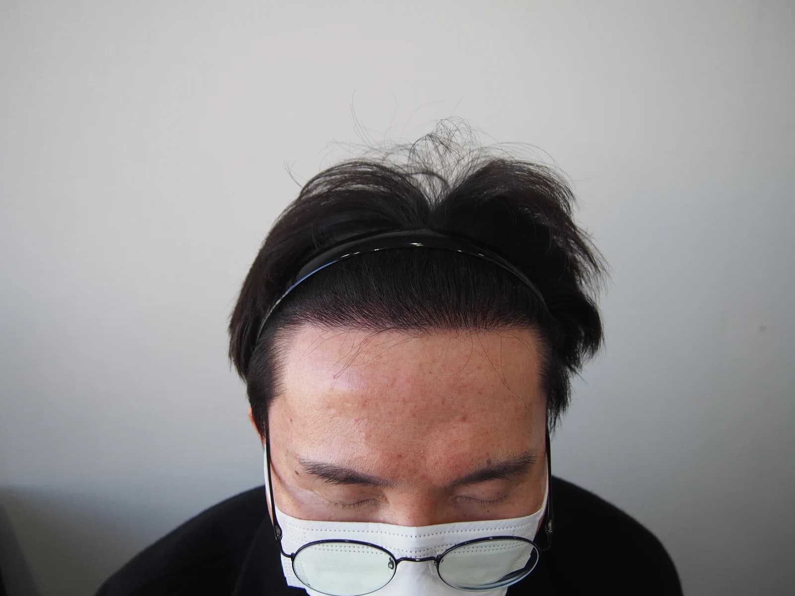 수술 후 사진