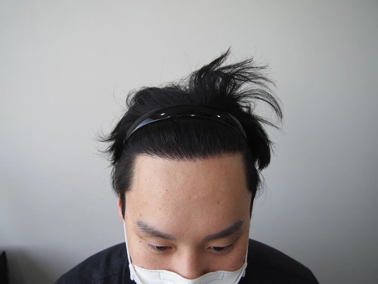 수술 후 사진