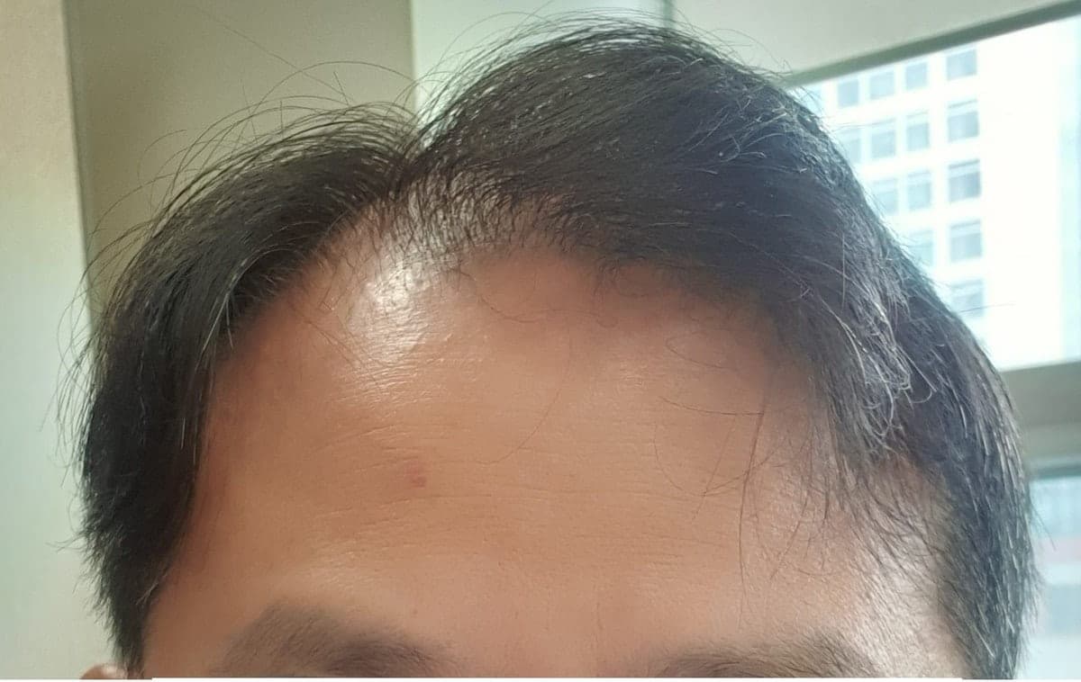 Post-surgery photo shared by the reviewer