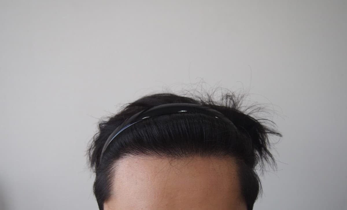投稿者が掲載した手術後の写真
