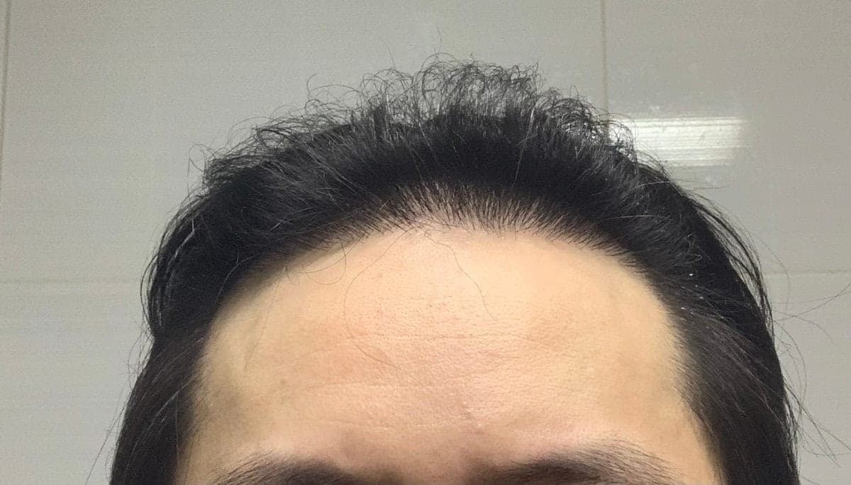投稿者が掲載した手術後の写真