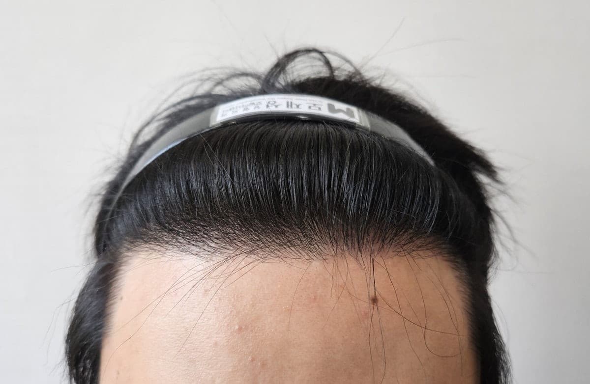 投稿者が掲載した手術後の写真