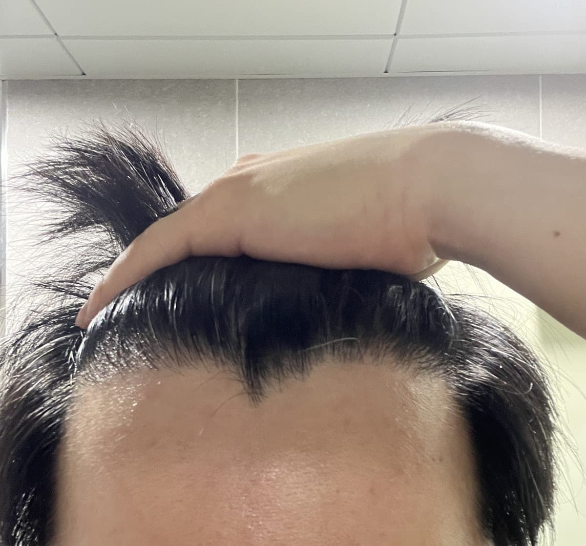 作者发布的术后照片
