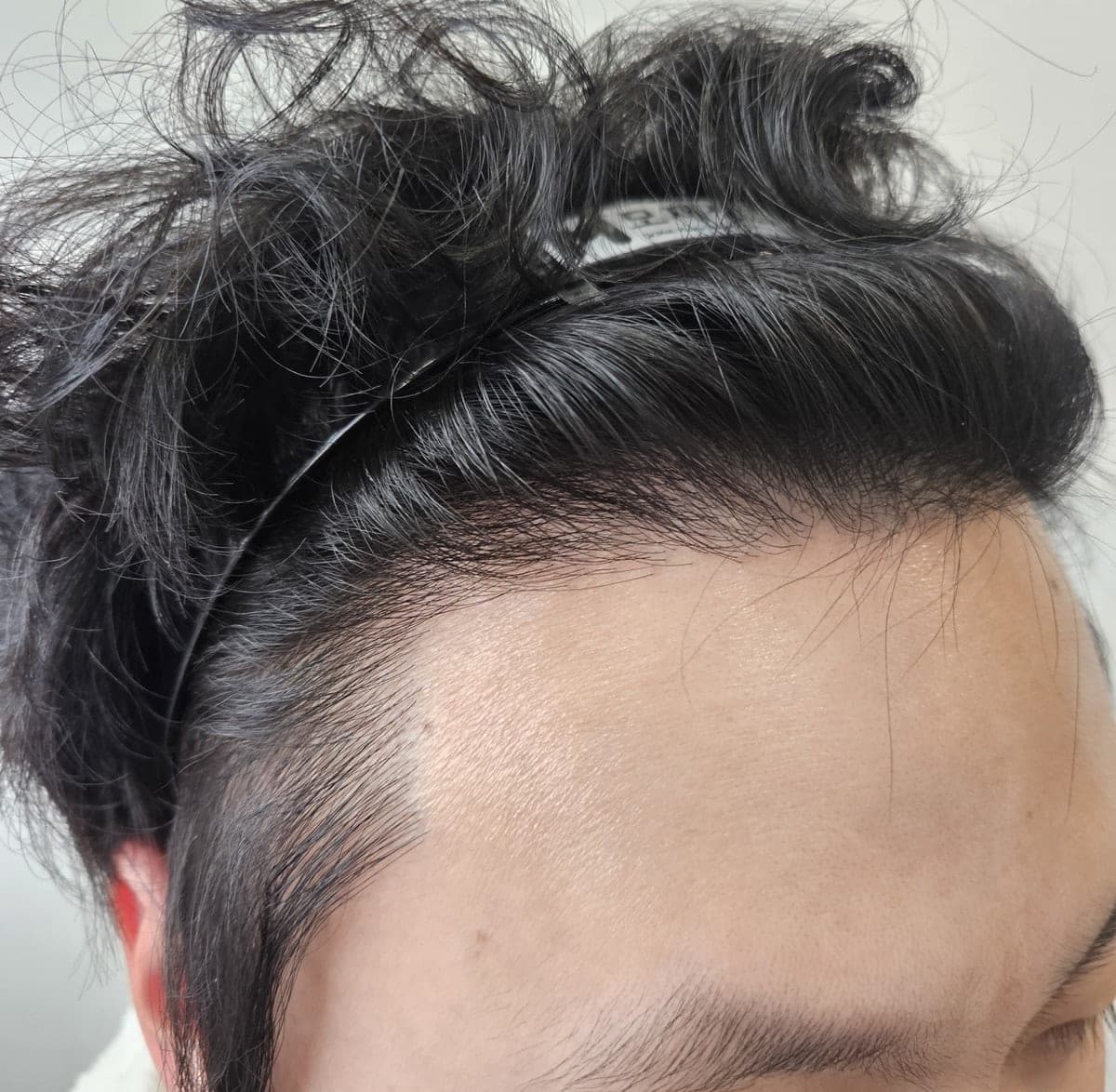 投稿者が掲載した手術後の写真