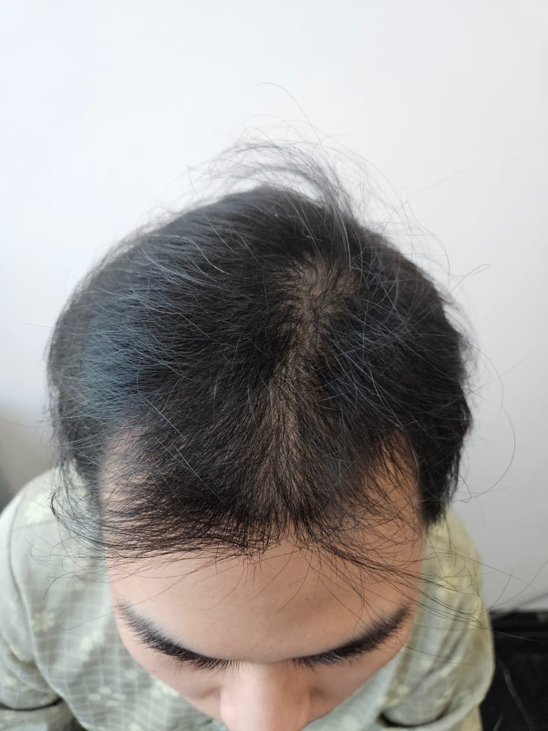 投稿者が掲載した手術後の写真