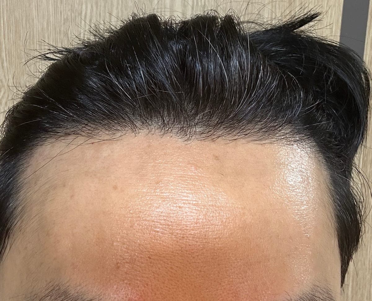 投稿者が掲載した手術後の写真