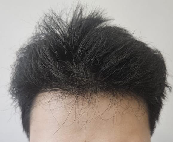 작성자가 게시한 수술 후 사진