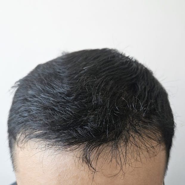 작성자가 게시한 수술 후 사진