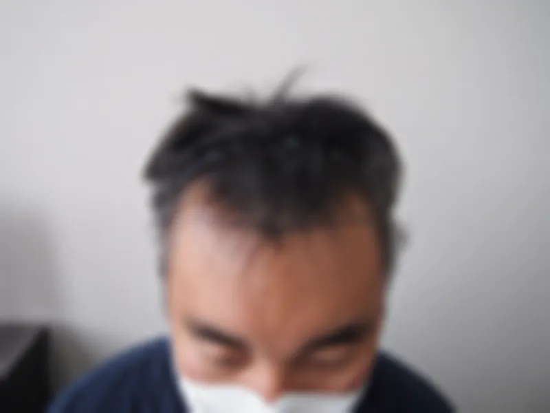 수술 전 사진의 열람 제한 미리보기