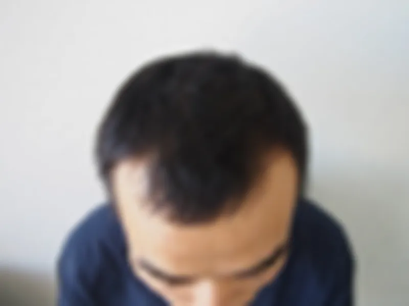수술 전 사진의 열람 제한 미리보기