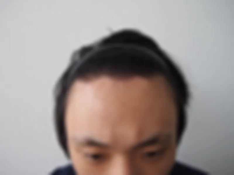 수술 전 사진의 열람 제한 미리보기