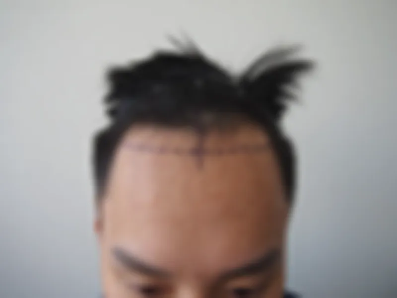 수술 전 사진의 열람 제한 미리보기