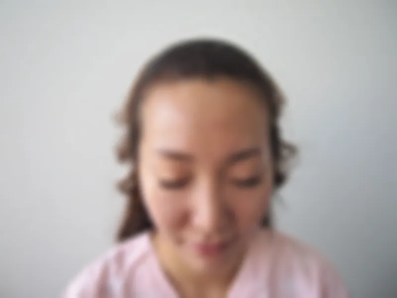 수술 전 사진의 열람 제한 미리보기