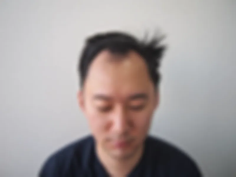 수술 전 사진의 열람 제한 미리보기