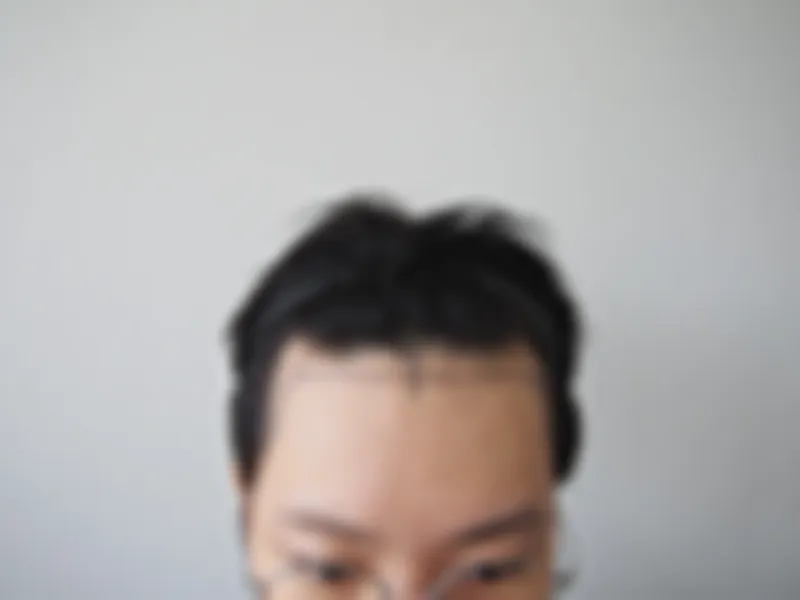수술 전 사진의 열람 제한 미리보기