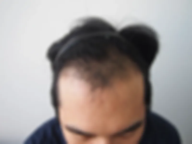 수술 전 사진의 열람 제한 미리보기