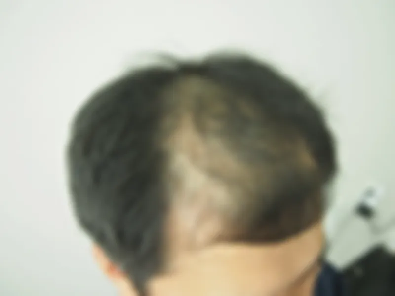 수술 전 사진의 열람 제한 미리보기